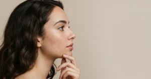 A woman with red acne scars needs acne scar treatment in East Greenwich, RI